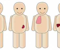 Transplantation d'organes