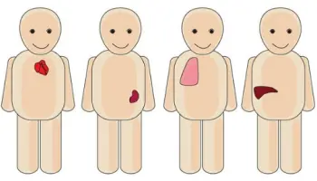 Organtransplantationen